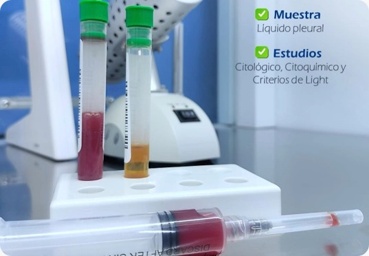 Área de Laboratorio LAESH